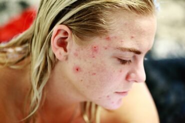 ¿El masaje facial puede aliviar la tensión en la mandíbula o el cuello?